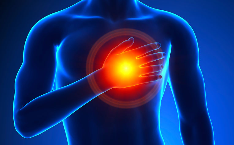 Great News for Recurrent Pericarditis Sufferers…