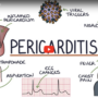 Understanding Pericarditis: A Guide for Medical Students and Laypeople